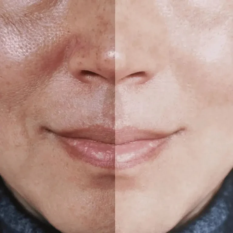 beaforeafter-woman-face (1)