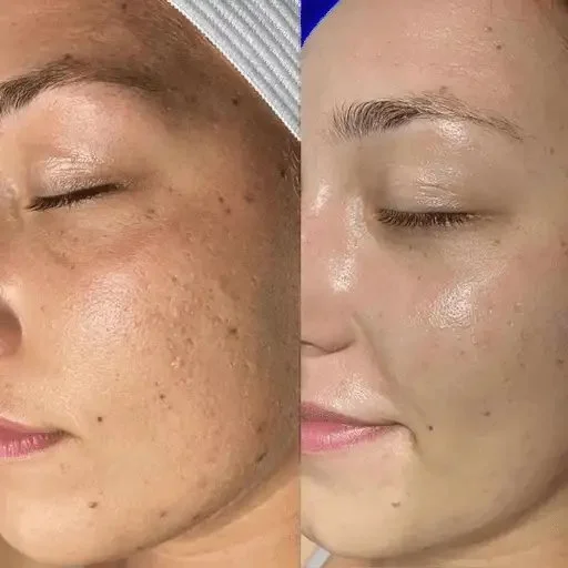 beaforeafter-woman-face1 (2)