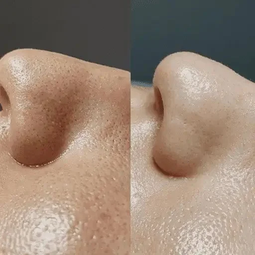 beaforeafter-woman-face2 (1)